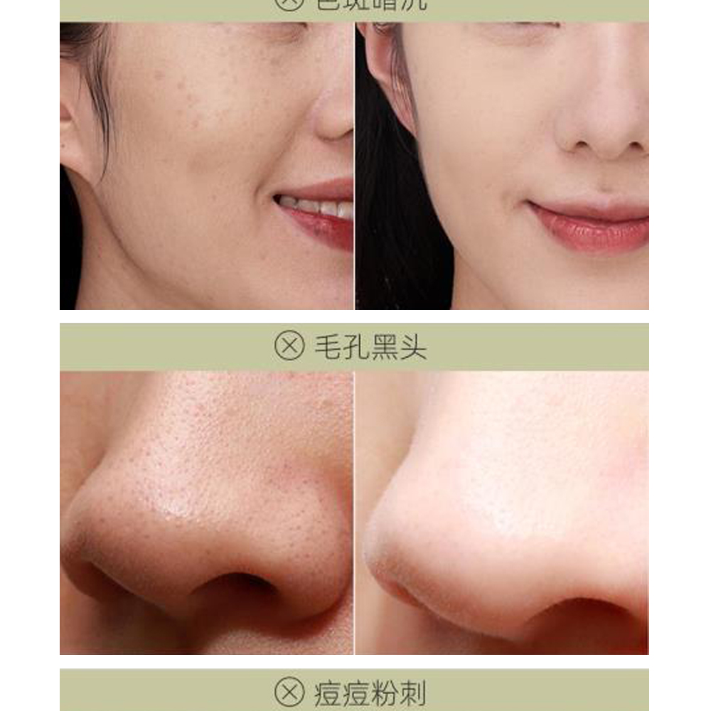 複配2大修護保濕精萃  傳統清潔面膜大多依靠強吸附成分與物理摩擦的方式來進行深層清潔，這種方式不僅難以排出肌底“垃圾”，而且很容易對肌膚屏障造成傷害，引發乾燥、敏感等問題。外在去油排濁，內在深潤養護，才是深層清潔的正確打開方式，抹茶清潔面膜複配2大修護成分：積雪草提取物、透明質酸鈉，高效修護潤養、補水去油、極致溫和，3倍提升修護力，讓肌膚乾淨通透，水潤光滑。